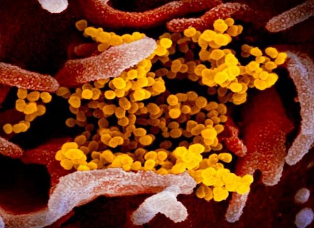 راهکار نوین کرهایها برای مقابله با التهاب ریه کرونا